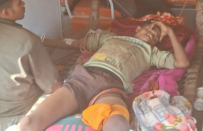 प्रेशर IED की चपेट में आया नाबालिग, पैर में गंभीर चोट
